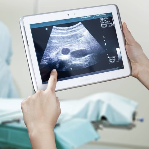 Foto: Im Vordergrund hält eine Hand ein Tablet mit einer Ultraschalldarstellung, im Hintergrund unscharf zwei Menschen in grüner medizinischer Schutzkleidung und eine Liege.