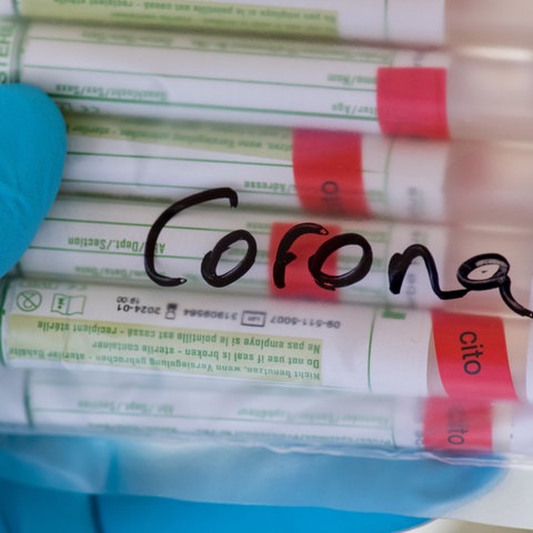 Corona-Test-Röhrchen
