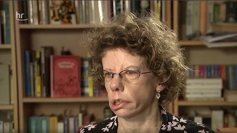 Zoe Cross, a woman with facial paralysis, talks to senior staff in front of a bookshelf