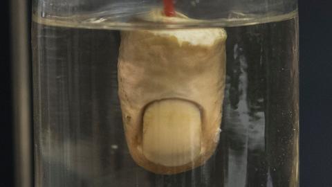 Der in Formaldehyd eingelgte Finger einer unbekannten Leiche ist im Kriminalmuseum im Polizeipräsidium Frankfurt zu sehen. 