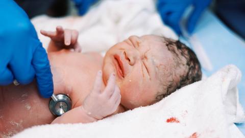 Ein frisch geborener Säugling liegt in einem blutverschmierten Tuch. Eine Hand mit blauem Handschuh hört ihn mit einem Stetoskop ab.