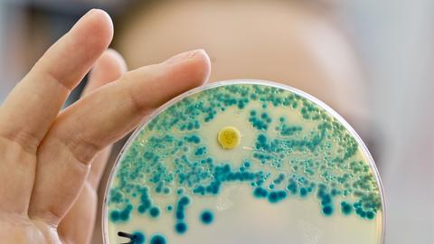 Eine Labormitarbeiterin hält eine Petrischale zum Nachweis resistenter Bakterien in der Hand